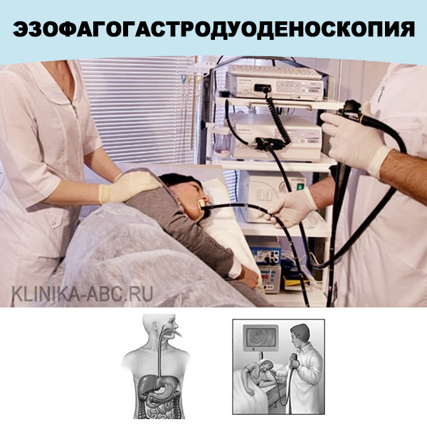Колоноскопия и гастроскопия во сне в москве цены thumbnail